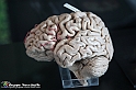 VBS_2950 - Cervello. Morbo di Alzheimer - Mostra Body Worlds